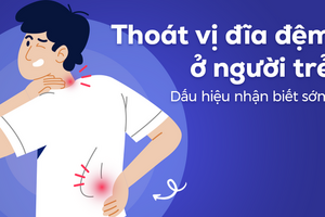 Thoát vị đĩa đệm ở người trẻ: Dấu hiệu nhận biết sớm