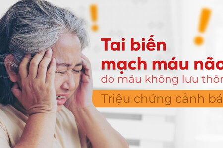 Tai biến mạch máu não do máu không lưu thông: Triệu chứng cảnh báo