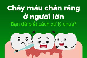 Chảy máu chân răng ở người lớn: Bạn đã biết cách xử lý chưa?