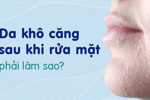 Da khô căng sau khi rửa mặt phải làm sao?