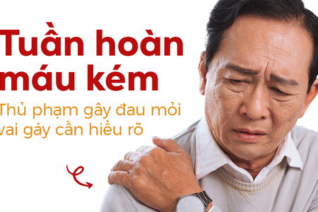 Tuần hoàn máu kém – Thủ phạm gây đau mỏi vai gáy cần hiểu rõ