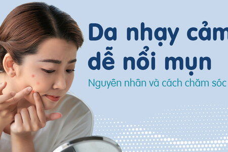 Da nhạy cảm dễ nổi mụn: Nguyên nhân và cách chăm sóc