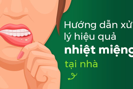 Hướng dẫn xử lý nhiệt miệng hiệu quả tại nhà