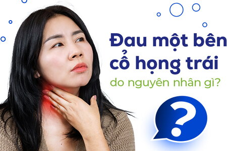 Đau một bên cổ họng trái do nguyên nhân gì?