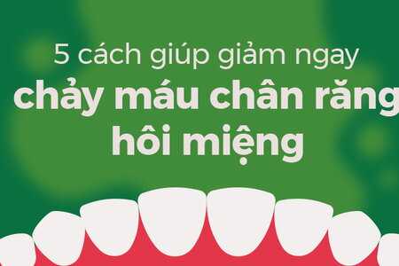 5 cách giúp giảm ngay chảy máu chân răng hôi miệng