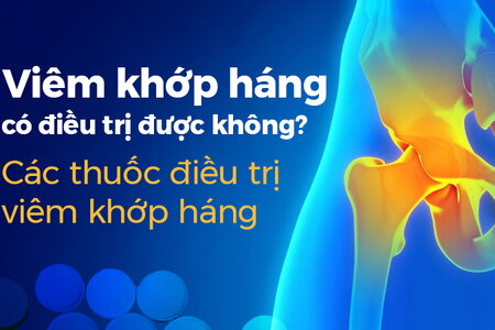 Viêm khớp háng có điều trị được không: Thuốc điều trị viêm khớp háng