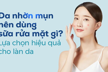 Da nhờn mụn nên dùng sữa rửa mặt gì? Lựa chọn hiệu quả cho làn da