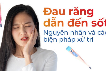 Đau răng dẫn đến sốt: Nguyên nhân và các biện pháp xử trí