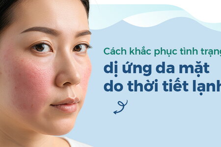 Cách khắc phục tình trạng dị ứng da mặt do thời tiết lạnh