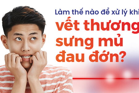 Làm thế nào để xử lý khi vết thương sưng mủ đau đớn?