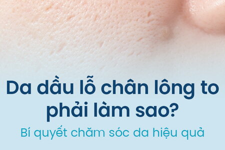 Da dầu lỗ chân lông to phải làm sao? Bí quyết chăm sóc da hiệu quả