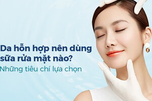 Da hỗn hợp nên dùng sữa rửa mặt nào? Những tiêu chí lựa chọn