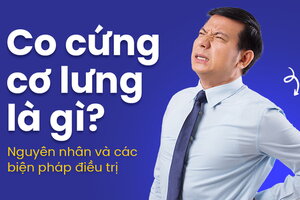 Co cứng cơ lưng là gì? Nguyên nhân và các biện pháp điều trị