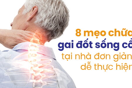 8 mẹo chữa gai đốt sống cổ tại nhà đơn giản, dễ thực hiện