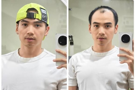 Chồng H'Hen Niê nhập viện ngay sau đám cưới, lý do ai nấy bất ngờ