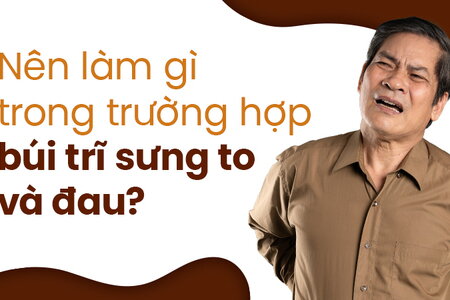 Nên làm gì trong trường hợp búi trĩ sưng to và đau?