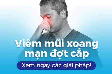 Viêm mũi xoang mạn đợt cấp: Xem ngay các giải pháp!