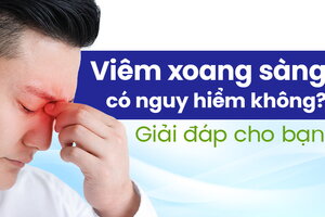 Viêm xoang sàng có nguy hiểm không? Giải đáp cho bạn