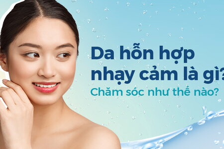 Da hỗn hợp nhạy cảm là gì? Chăm sóc như thế nào?