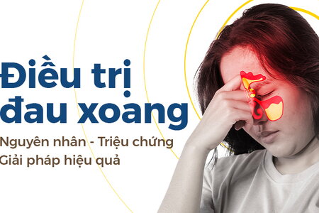 Điều trị đau xoang: Nguyên nhân – Triệu chứng – Giải pháp hiệu quả