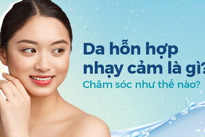 Da hỗn hợp nhạy cảm là gì? Chăm sóc như thế nào?