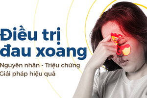 Điều trị đau xoang: Nguyên nhân – Triệu chứng – Giải pháp hiệu quả