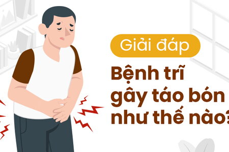 Giải đáp: Bệnh trĩ gây táo bón như thế nào?