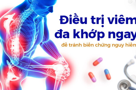 Điều trị viêm đa khớp ngay để tránh biến chứng nguy hiểm