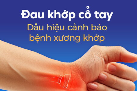 Đau khớp cổ tay: Dấu hiệu cảnh báo bệnh xương khớp
