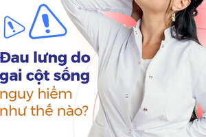 Đau lưng do gai cột sống nguy hiểm như thế nào?