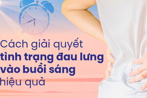 Cách giải quyết tình trạng đau lưng vào buổi sáng hiệu quả