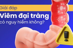 Giải đáp: Viêm đại tràng có nguy hiểm không?