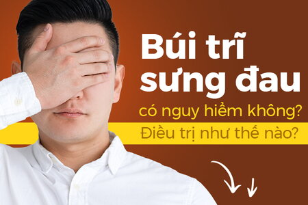 Búi trĩ sưng đau có nguy hiểm không? Điều trị như thế nào?