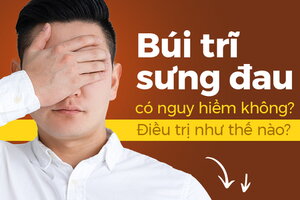 Búi trĩ sưng đau có nguy hiểm không? Điều trị như thế nào?