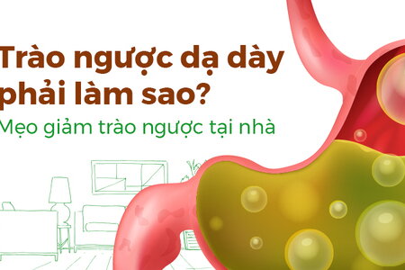Trào ngược dạ dày phải làm sao? Mẹo giảm trào ngược tại nhà