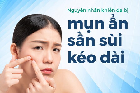 Nguyên nhân khiến da bị mụn ẩn sần sùi kéo dài