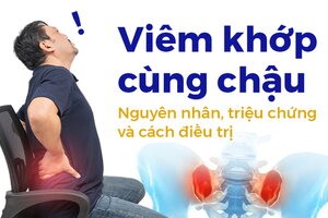 Viêm khớp cùng chậu: Nguyên nhân, triệu chứng và cách điều trị