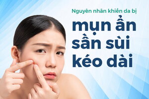 Nguyên nhân khiến da bị mụn ẩn sần sùi kéo dài