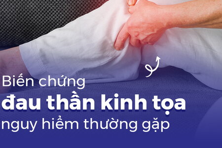 Biến chứng đau thần kinh tọa nguy hiểm thường gặp