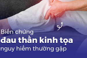 Biến chứng đau thần kinh tọa nguy hiểm thường gặp