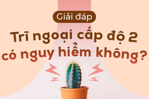 Giải đáp: Trĩ ngoại cấp độ 2 có nguy hiểm không?