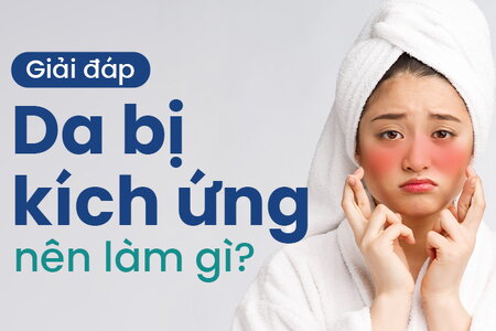 Giải đáp: Da bị kích ứng nên làm gì?