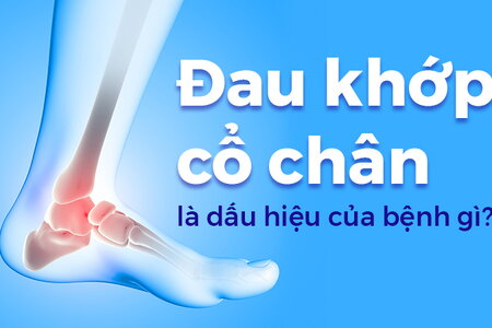 Đau khớp cổ chân là dấu hiệu của bệnh gì?