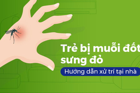 Trẻ bị muỗi đốt sưng đỏ: Hướng dẫn xử trí tại nhà