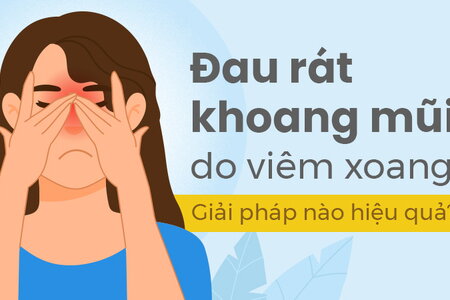 Đau rát khoang mũi do viêm xoang: Giải pháp nào hiệu quả?