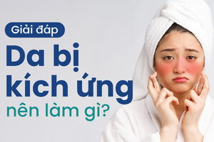 Giải đáp: Da bị kích ứng nên làm gì?