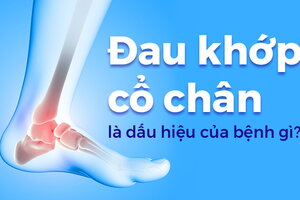 Đau khớp cổ chân là dấu hiệu của bệnh gì?