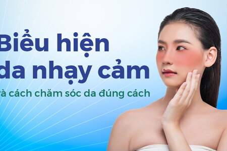 Biểu hiện da nhạy cảm và cách chăm sóc da đúng cách