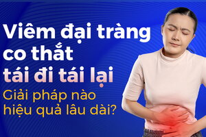 Viêm đại tràng co thắt tái đi tái lại Giải pháp nào hiệu quả lâu dài