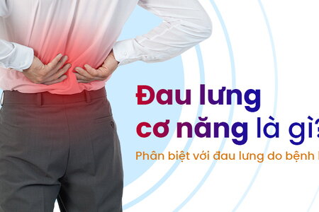 Đau lưng cơ năng là gì? Phân biệt với đau lưng do bệnh lý